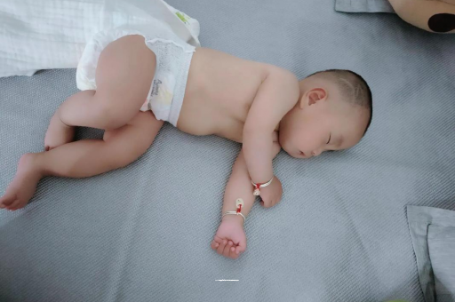 杭州六个月宝宝眼睛散光 杭州六个月宝宝眼睛散光